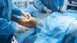 Cobertura de seguro para tratamientos de venas: ¡Medicare se preocupa!