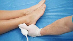 Mantén la calma y la esclerosis: Tratamientos para las venas = factibles