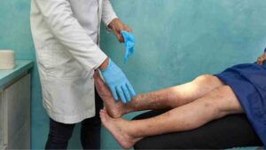 Tratamientos de venas + Compartir = Cuidado de venas Rosen