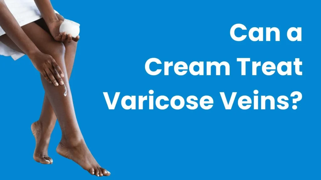 Can a Cream Treat Varicose Veins?