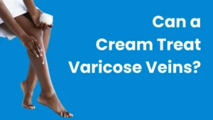 Can a Cream Treat Varicose Veins?