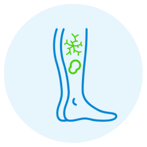 Ulcers / Sores / Open Wounds