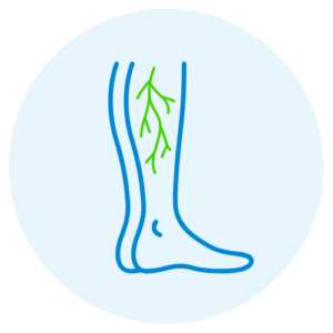 Varicose and Spider Veins