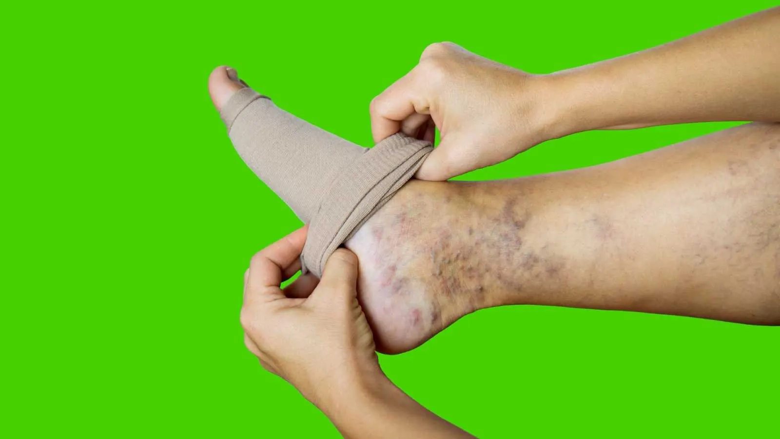 Compression stockings