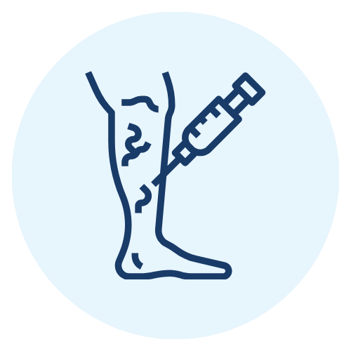 Sclerotherapy